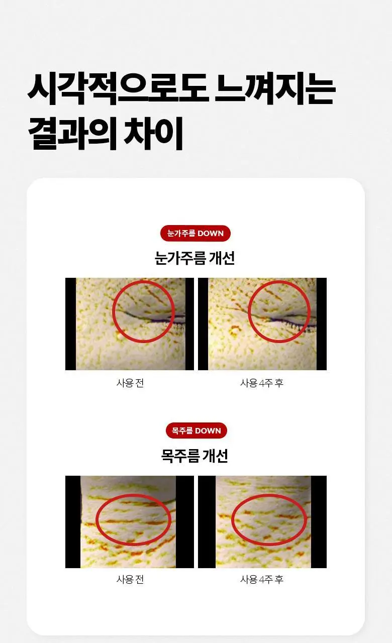 [눈가&목/레티날0.025%] 닥터디퍼런트 비타리프트 아이앤넥 크림 20g 상세페이지 22